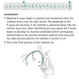 Localisation-Product Picture Enlargement CW