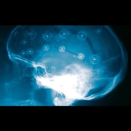 CranioFix®2-Product Picture CW Enlargement